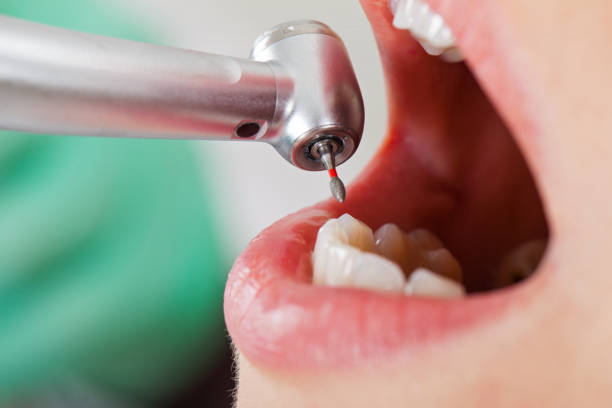 Best Same-Day Emergency Dental Services in Carrizo Hill, TX